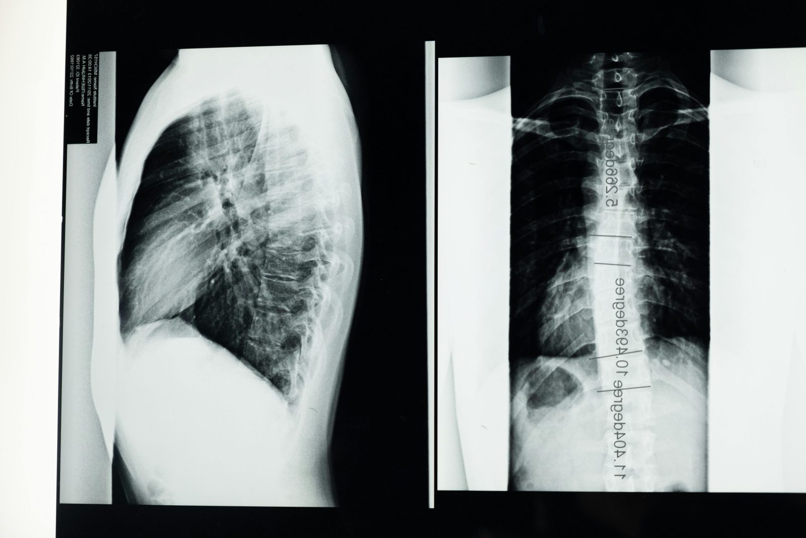 CrossFit y dolor lumbar: causas, prevención y cómo entrenar con seguridad 🧠🏋️‍♀️
